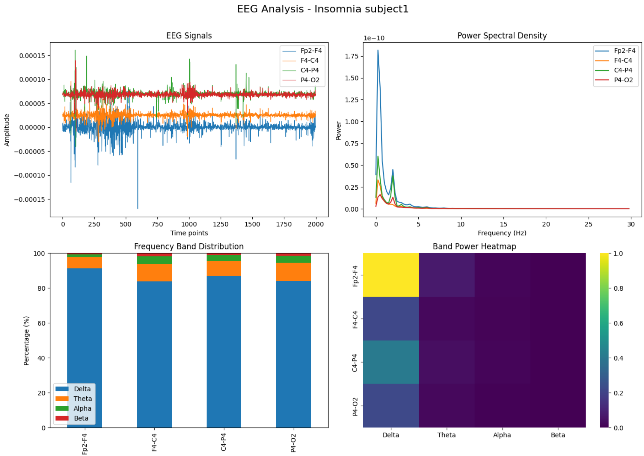 EEG Insomniac Subject1 Analysis