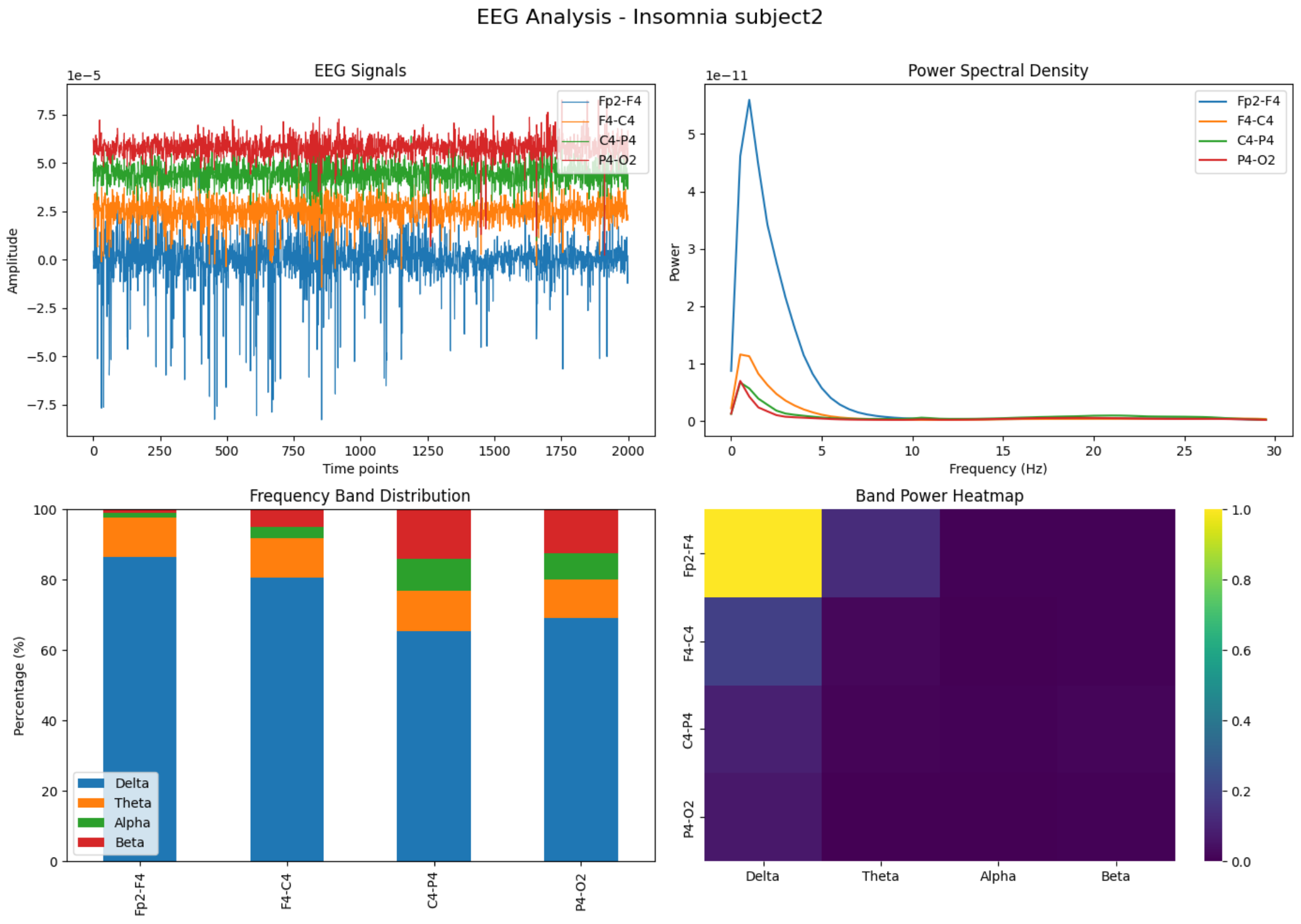 EEG Insomniac Subject2 Analysis