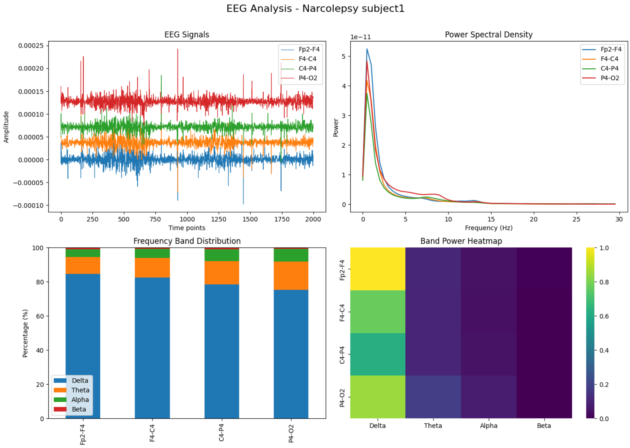 EEG Narcoleptic Subject1 Analysis