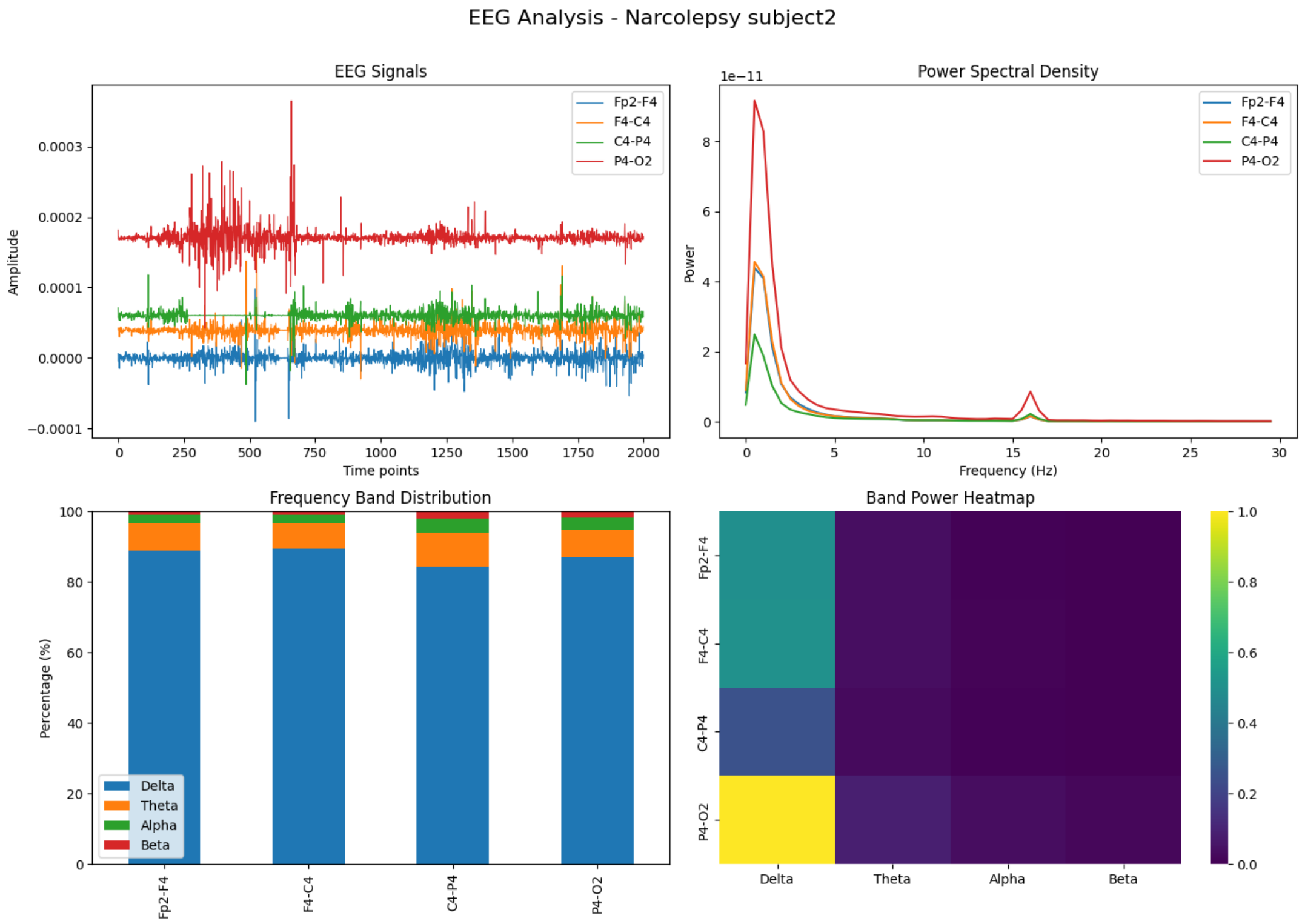 EEG Narcoleptic Subject2 Analysis