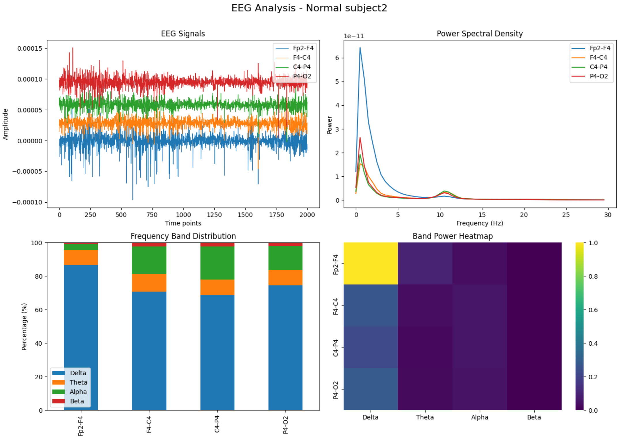EEG Normal Subject2 Analysis