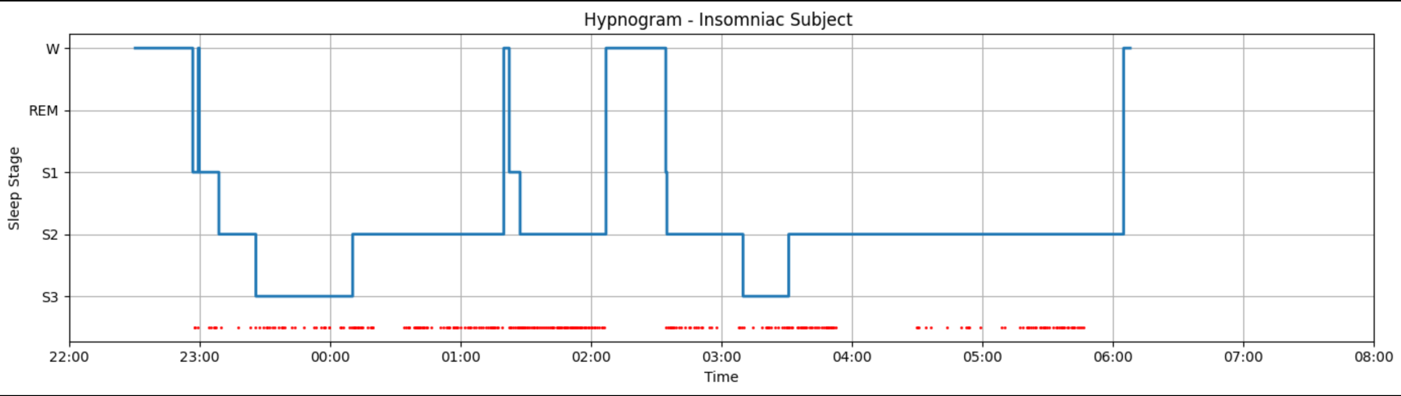 Hypnogram for Insomniac Subject