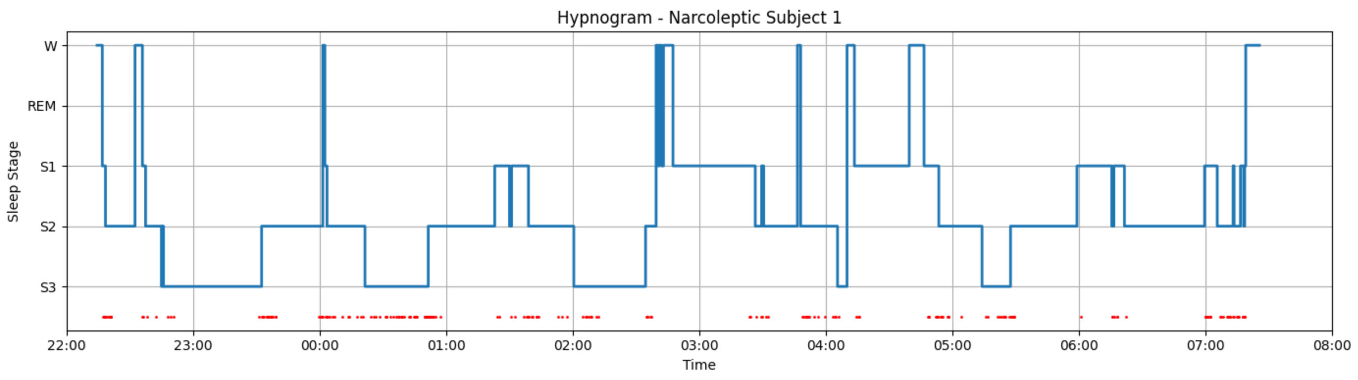 Hypnogram for Narcoleptic Subject